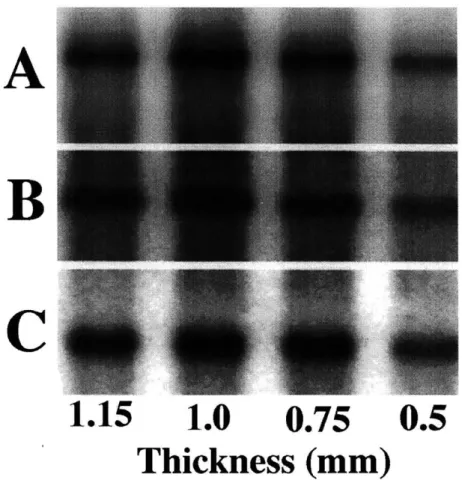 Figure  2.2:  Expression  of aggrecan  and  type  II  collagen  mRNA  in  response  to static compression  as  assessed  by  Northern  blot