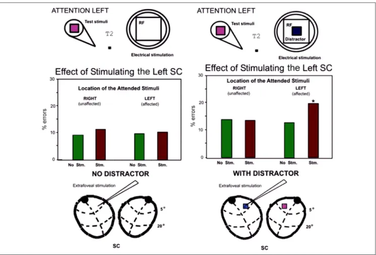 Figure 6. Ineffective and effective shifts of attention in Case 2. (A) Stimulation of unattended sites without a distractor causes little or no impairment