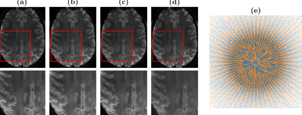 Figure 1: Top: (a) Cartesian reference; (b): our self-calibrating approach; (c):` 1 -ESPIRiT and (d): OSCAR-based calibrationless reconstruction from 8-fold accelerated prospective Sparkling acquisition shown in (e)