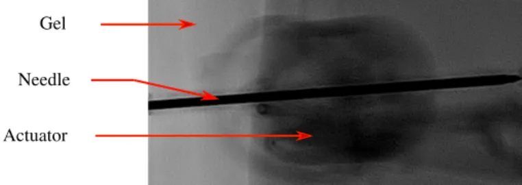 FIGURE 14 : X-RAY IMAGE OF ACTUATOR WITH NEEDLE POSITIONED ON A GEL.