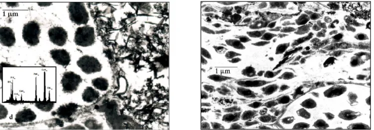 Figure  5a  -  5b.  Transmission  electron  micrographs  of  (a)  biological  waste  water  and  (b)  cake  of  filtration sections (0.1 µm) 