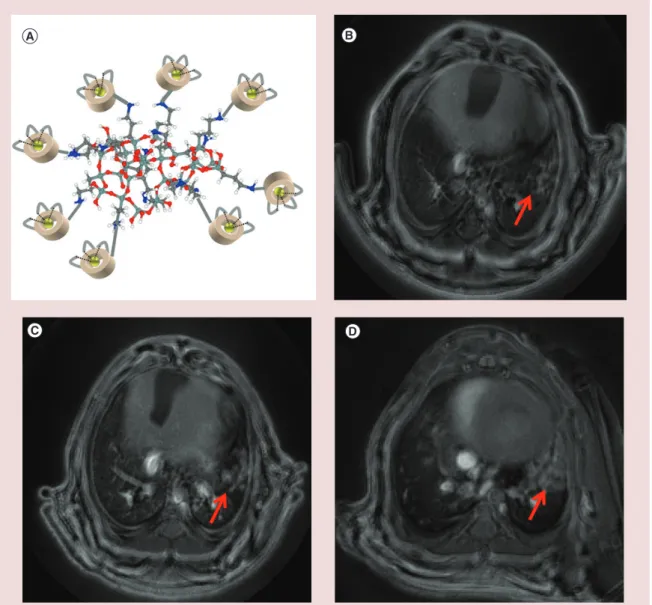 Figure 3. Detection of lung tumor by MRI. (A) Schematic representation of AGuIX with polysiloxane core and  DOTA(Gd) grafted to the inorganic matrix