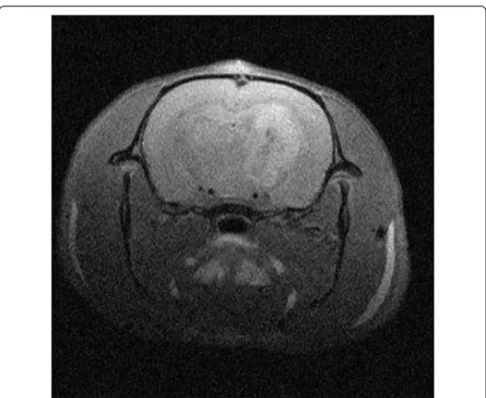 Figure 4 T 1 -weigthed images of the brain of a 9LGS bearing rat 1 day after intravenous injection of AGuIX nanoparticles.