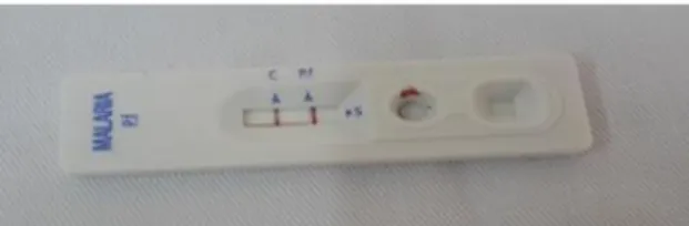 Figure  1 :  résultat  du  test  de  diagnostic  rapide  du  paludisme 