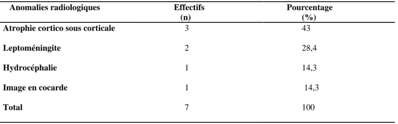 Tableau IV : Protocole thérapeutique chez les patients infectés par Cryptococcus neoformans au cours du VIH  au service de Maladies Infectieuses au CHU Mohamed VI 