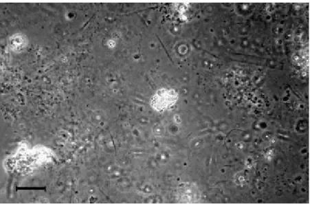 Fig. 8  Structure of clouds. A more decayed structure as compared with that of surface  macroaggregates can be seen (scale bar 30 µm) 