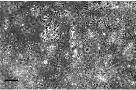Fig. 3  Heterogeneous structure of surface macroaggregates. Among a variety of organisms and  particles, some amoeboid structures can be observed (scale bar 60 µm) 