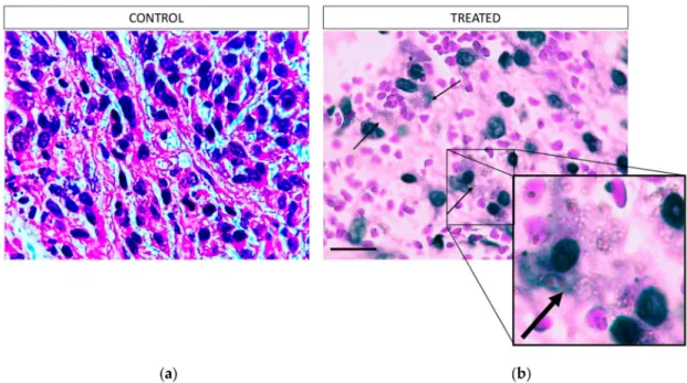 Figure 7. Representative images of H&amp;E-stained slices of U-87 MG tumor tissue after the therapeutic efficacy study in mice, from the area of the necrotic lesion (100 × magnification): (a) control mice, (b) treated mice