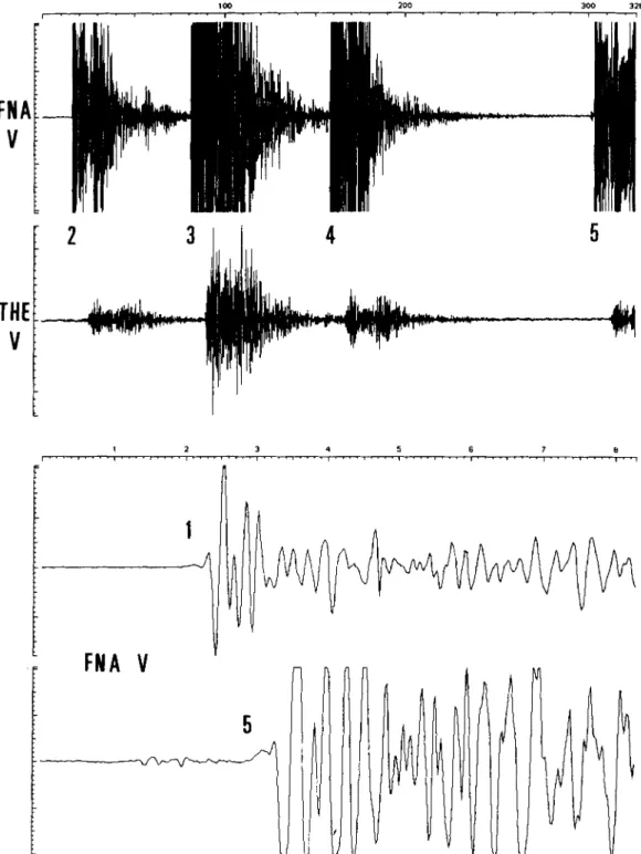 Figure 2.  Records of the foreshock sequence. Top: 300 s of record of the vertical component  at  stations FNA and THE, at the time of the foreshocks  (numbers 2 to 5 ) 