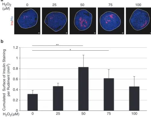 Figure 2 Effect of H 2 O 2 on β -cell development. (a) E13.5 rat pancreases were cultured for 7 days with H 2 O 2 (0 – 100 μ M)