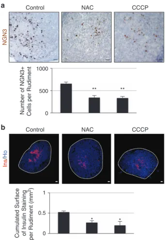 Figure 6 N-acetyl-cysteine and the mitochondrial agent CCCP alter β -cell differentiation