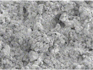 Fig. 4. SEM photograph (scale: 100 μm) showing the diversity of porosities in a tuffeau sample
