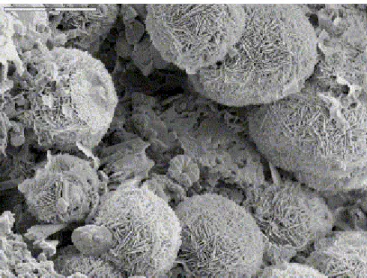 Fig. 5. SEM photograph (scale: 10 μm) showing a pore generated by opal CT spherules with a coccolith  (maritime fossil) in the centre of the image