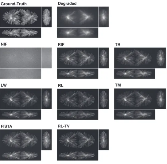Fig. 4. Orthogonal sections of the maximum intensity projection (MIP) of a degraded 3D synthetic volume after its deconvolution by DeconvolutionLab2 algorithms