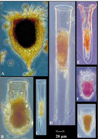 Fig. 1. Examples of tintinnid morphology. Note that although all loricas are basically tube- or vase-shaped, different species show distinct lorica architecture
