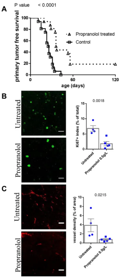 Figure 1: Comparison of tumor development in untreated control and propranolol treated MT/ret mice