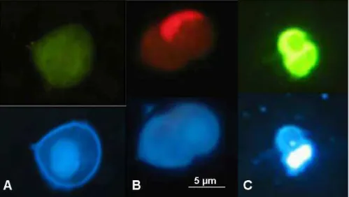 Fig. 4. Heterotrophic (A)), autotrophic (B), and green dinoflagellates (C) observed under blue light excitation (top) and UV light excitation (bottom)