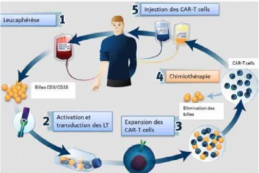 Figure 2. Production des CAR-T à partir du sang périphérique d’un patient