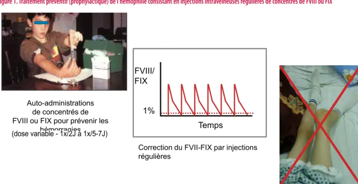 Figure 1: Traitement préventif (prophylactique) de l’hémophilie consistant en injections intraveineuses  régulières de concentrés de FVIII ou FIX