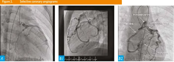 Figure 2.   Selective coronary angiograms
