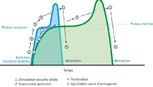 Figure 3.   A - Courbe d’une éjaculation normale.  