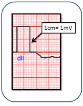 Figure 5.  Papier millimétré utilisé pour l’enregistrement de l’ecG.  echelles de temps et de voltage