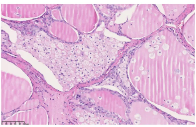 Figure 1 :   Coupe d’un lobe thyroïdien (grossissement 