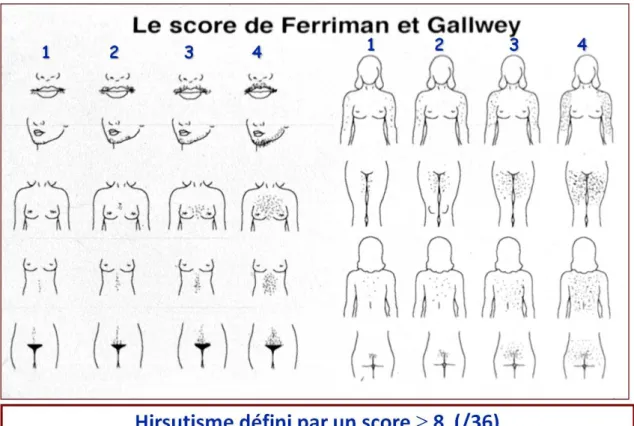 Figure 4 :   Score de Ferriman et Gallwey