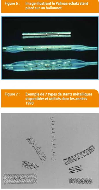 Figure 7 :  exemple de 7 types de stents métalliques  disponibles et utilisés dans les années  1990