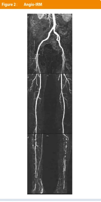 Figure 2 :   Angio-IRM 