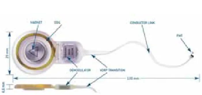 Figure 3 : Bobine fixée à l’enclume 