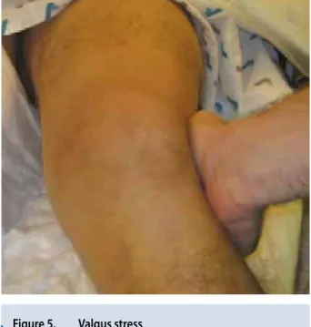 Figure 3.  Kyste arthro-synovial