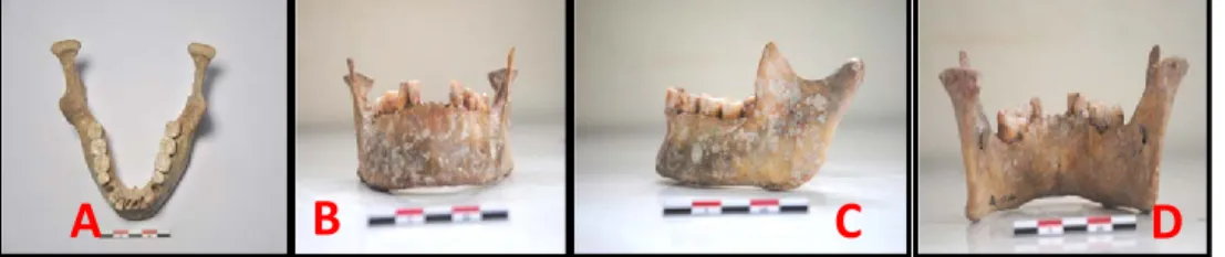 Figure 8.  Mandibule de H3, A : vue supérieure, B : vue de face, C : vue latérale, D :     