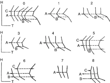 Fig. 1. Tropopause types and change of vertical temperature gradient within the tropopause (A ± tropopause level, B and C ± lower and upper tropopause bounds)