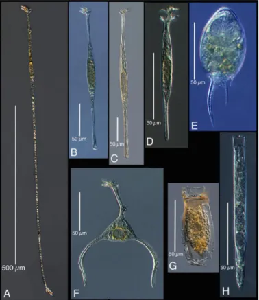 Fig.   13.   Examples   of   forms   found   in   the   samples   from   250m   depth   at   two   sites   in   the   North    Atlantic   Ocean   near   the   Azores