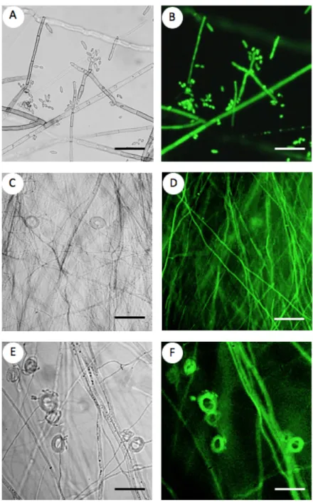 Fig. 2. Fluorescence microscopy analysis of the selected DSE transformants. 