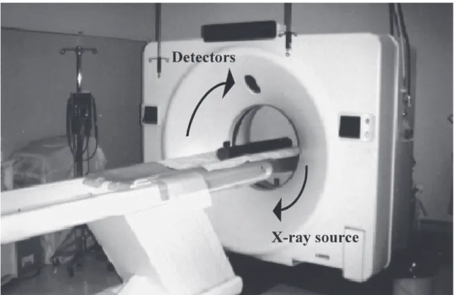 Fig. 2. Computer axial tomograph (CAT-Scan).