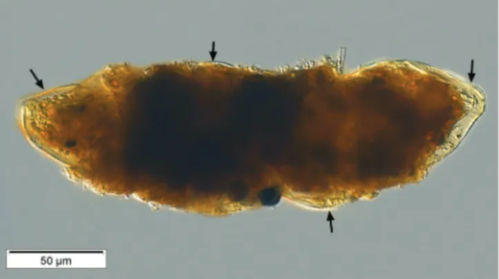Fig. 9. Fecal pellet containing loricas of Ptychocylis urnula (arrows)  found in material from the 2012 Station 40