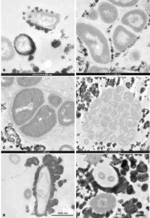 Fig. 3. TEM views illustrating the di ff erent ways the minerals may be deposited on the rod- rod-shaped bacteria in Rimicaris exoculata