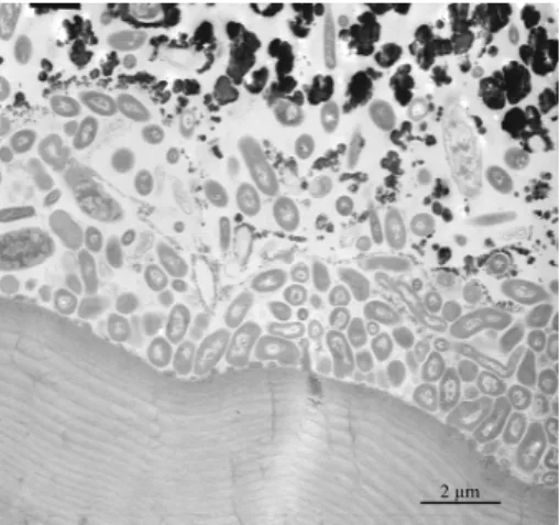 Fig. 4. Bacteria-mineral interactions in Rimicaris exoculata. TEM view of the lower level (ver- (ver-tical cross-section) where rod-shape bacteria are very abundant