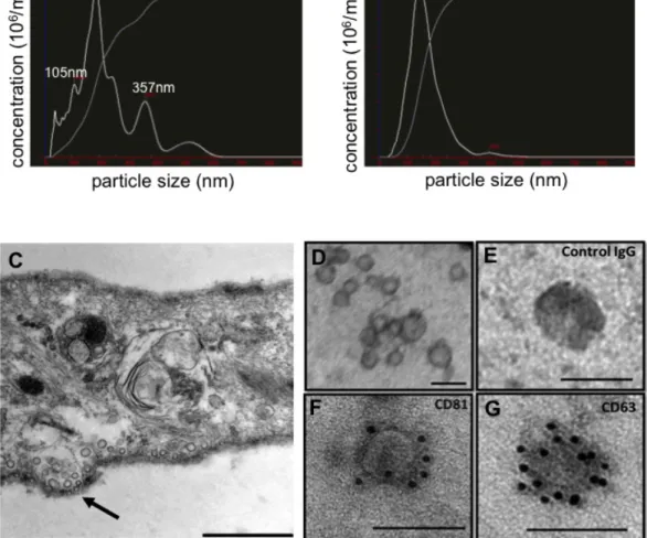 Figure 1: Characterization of EVs isolated from hMSCs conditioned medium.  (A) Particle size distribution in hMSCs  conditioned media as determined by NanoSight and in (B) purified hMSCs EVs