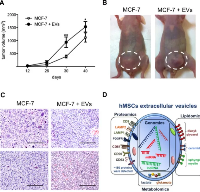 Figure 5: EVs enhance breast tumor growth.  (A) Xenograft assays of MCF-7 cells with or without EVs