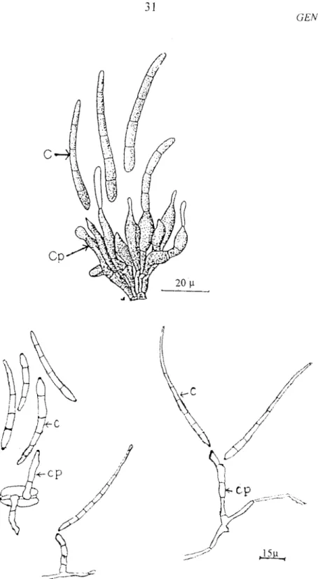 Figure  6:  Structures  conidiennes  de  Cercospora  musae  et  Cercopora fijiensis 
