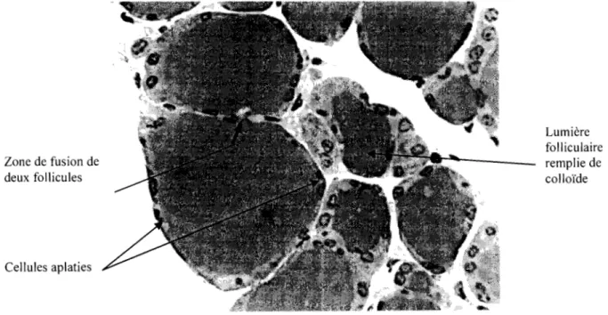 Figure N°6:  Goitre colloïde vu en microscopie optique X 560  (tiré de Gangbo,  1990;  page  54') 