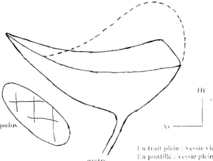 Fig.  1 : Coupe sagittale du  pctit  lnlssin  configuration  externe de la  ycssie 