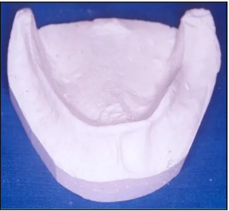 Figure 20 : Modèle mandibulaire standard 
