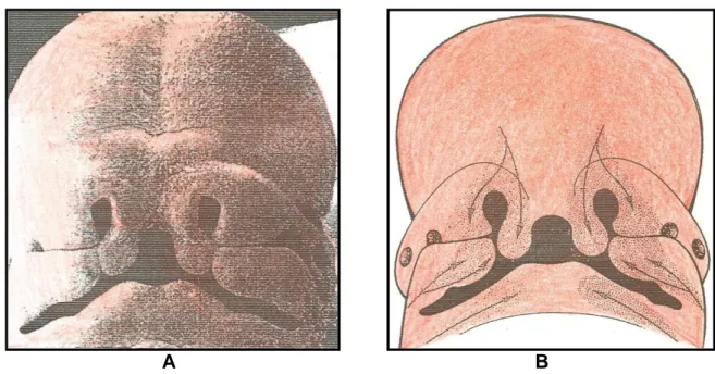 Figure 1 : (A) Aspect du massif facial d’un embryon humain de 42 jours en                          microscopie électronique à balayage