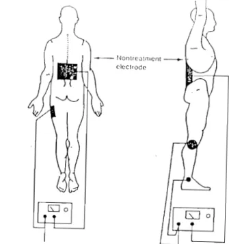 Fig.  5.2  - Technique  bipolaire 