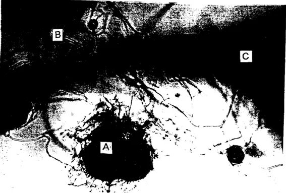 Figure 13.  Hyphes externes et spores du champignon endomycorhzien  sur une racine  d'A