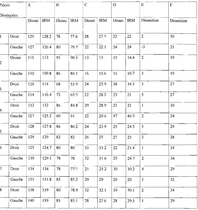 Tableau 1: Mensurations des distances en millimètres (mm) sur les hémisphères par la méthode de KLINGLER